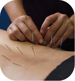 needle-therapy
