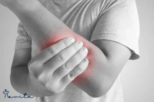 کشیدگی عضله دست چپ چیست و چگونه درمان می‌شود؟