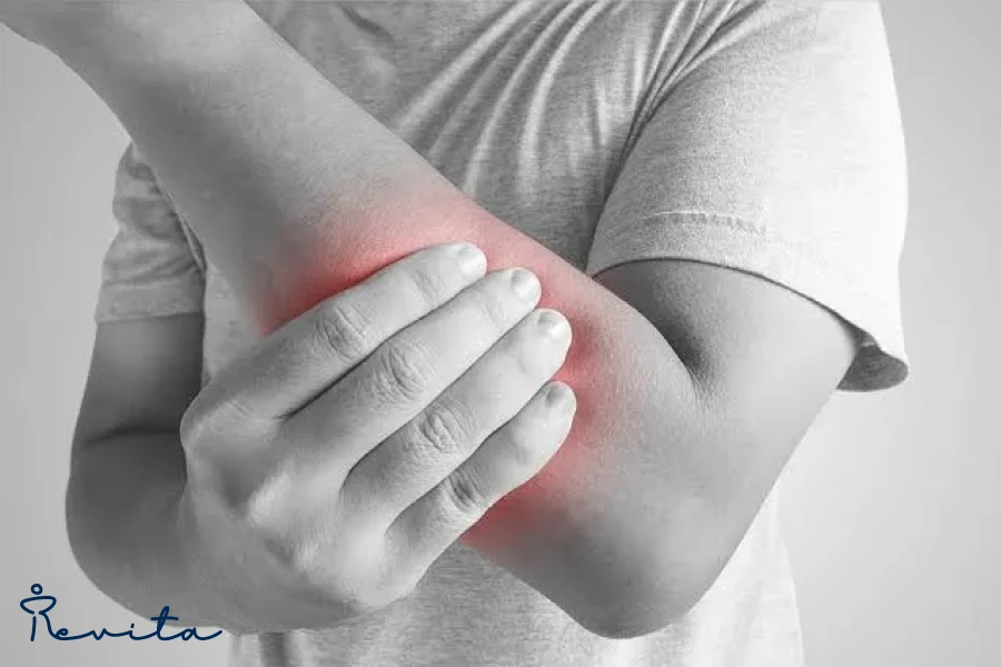 کشیدگی عضله دست چپ چیست و چگونه درمان می‌شود؟